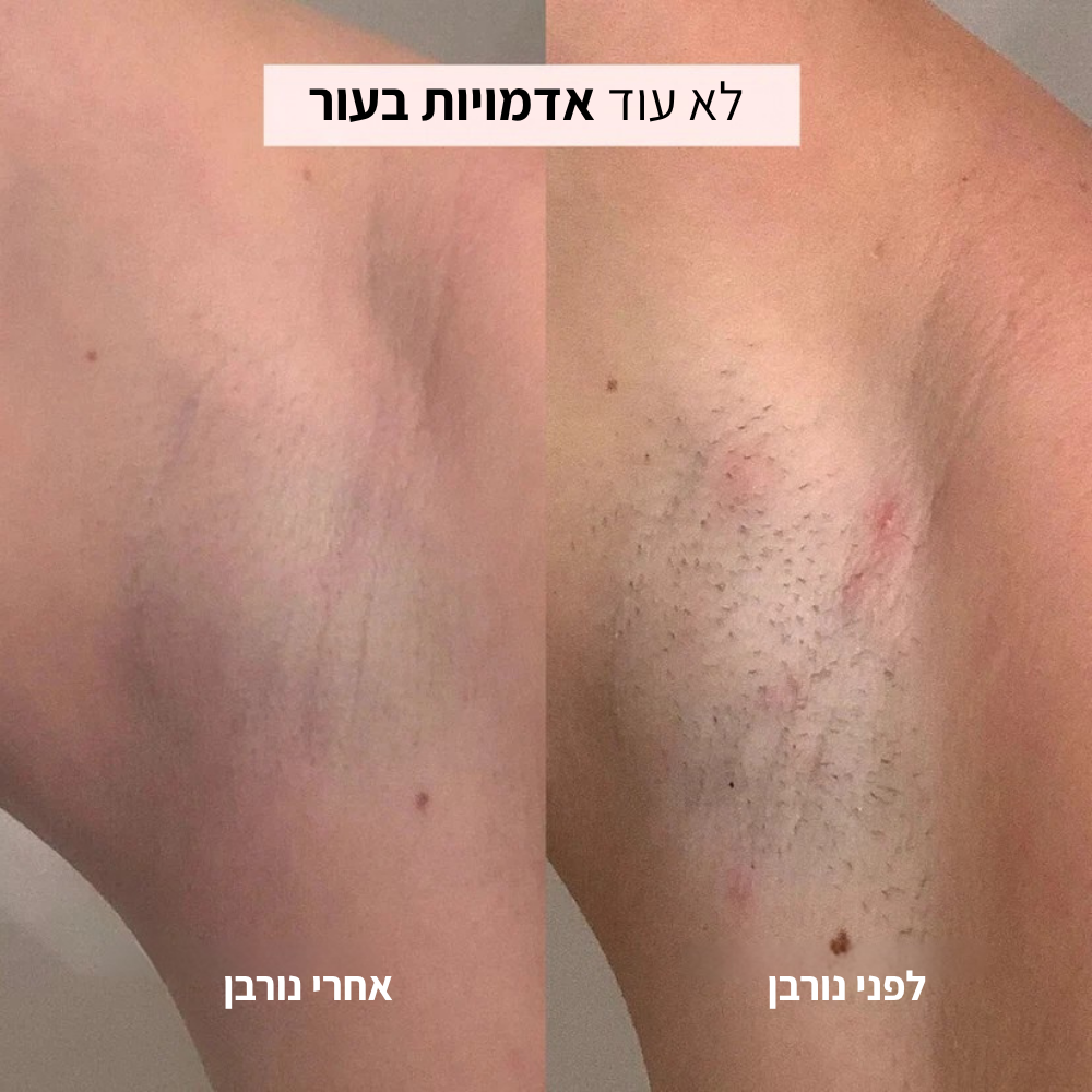 מכונת הגילוח של Norven