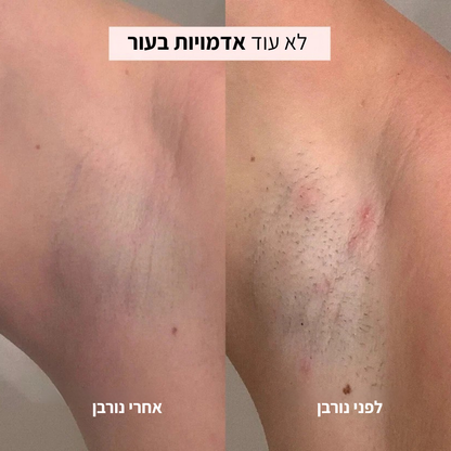 מכונת הגילוח של Norven