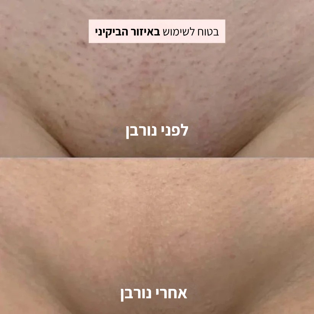 מכונת הגילוח של Norven